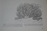 Histologie Warze.jpg